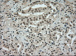 BUB1B Antibody in Immunohistochemistry (Paraffin) (IHC (P))