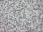 BUB1B Antibody in Immunohistochemistry (Paraffin) (IHC (P))