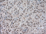 BUB1B Antibody in Immunohistochemistry (Paraffin) (IHC (P))