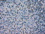 BUB1B Antibody in Immunohistochemistry (Paraffin) (IHC (P))