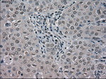 BUB1B Antibody in Immunohistochemistry (Paraffin) (IHC (P))