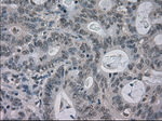 BUB1B Antibody in Immunohistochemistry (Paraffin) (IHC (P))