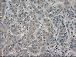 BUB1B Antibody in Immunohistochemistry (Paraffin) (IHC (P))