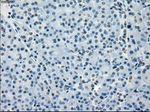 BUB1B Antibody in Immunohistochemistry (Paraffin) (IHC (P))