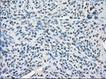 BUB1B Antibody in Immunohistochemistry (Paraffin) (IHC (P))