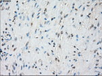 BUB1B Antibody in Immunohistochemistry (Paraffin) (IHC (P))