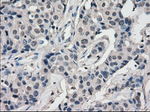 BUB1B Antibody in Immunohistochemistry (Paraffin) (IHC (P))