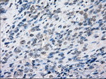 BUB1B Antibody in Immunohistochemistry (Paraffin) (IHC (P))