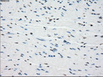 BUB1B Antibody in Immunohistochemistry (Paraffin) (IHC (P))