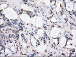 BUB1B Antibody in Immunohistochemistry (Paraffin) (IHC (P))