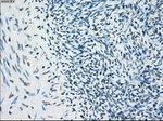 BUB1B Antibody in Immunohistochemistry (Paraffin) (IHC (P))