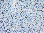 BUB1B Antibody in Immunohistochemistry (Paraffin) (IHC (P))