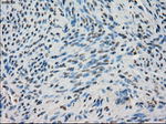 BUB1B Antibody in Immunohistochemistry (Paraffin) (IHC (P))