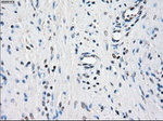 BUB1B Antibody in Immunohistochemistry (Paraffin) (IHC (P))