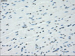 BUB1B Antibody in Immunohistochemistry (Paraffin) (IHC (P))