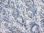 BUB1B Antibody in Immunohistochemistry (Paraffin) (IHC (P))