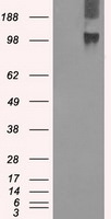 BUB1B Antibody in Western Blot (WB)