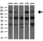 BUB1B Antibody in Western Blot (WB)