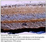 Beta crystallin S Antibody in Immunohistochemistry (IHC)