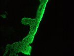 Cytokeratin 5 Antibody in Immunohistochemistry (Frozen) (IHC (F))