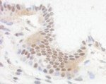 Bcl11b Antibody in Immunohistochemistry (IHC)