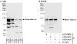 Beta-Adducin Antibody in Western Blot (WB)