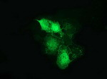 Beta-catenin Antibody in Immunocytochemistry (ICC/IF)