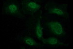 Beta-catenin Antibody in Immunocytochemistry (ICC/IF)