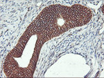 Beta-catenin Antibody in Immunohistochemistry (Paraffin) (IHC (P))