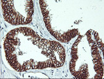 Beta-catenin Antibody in Immunohistochemistry (Paraffin) (IHC (P))