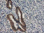 Beta-catenin Antibody in Immunohistochemistry (Paraffin) (IHC (P))