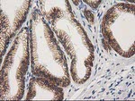 Beta-catenin Antibody in Immunohistochemistry (Paraffin) (IHC (P))