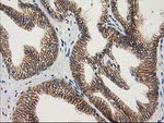 Beta-catenin Antibody in Immunohistochemistry (Paraffin) (IHC (P))