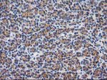 Beta-catenin Antibody in Immunohistochemistry (Paraffin) (IHC (P))