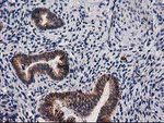 Beta-catenin Antibody in Immunohistochemistry (Paraffin) (IHC (P))