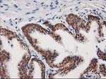 Beta-catenin Antibody in Immunohistochemistry (Paraffin) (IHC (P))