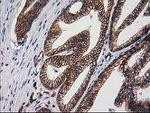 Beta-catenin Antibody in Immunohistochemistry (Paraffin) (IHC (P))