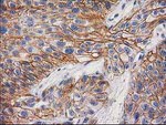 Beta-catenin Antibody in Immunohistochemistry (Paraffin) (IHC (P))