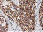 Beta-catenin Antibody in Immunohistochemistry (Paraffin) (IHC (P))