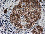 Beta-catenin Antibody in Immunohistochemistry (Paraffin) (IHC (P))