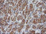 Beta-catenin Antibody in Immunohistochemistry (Paraffin) (IHC (P))