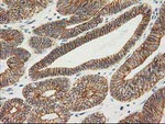 Beta-catenin Antibody in Immunohistochemistry (Paraffin) (IHC (P))