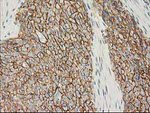 Beta-catenin Antibody in Immunohistochemistry (Paraffin) (IHC (P))