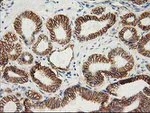 Beta-catenin Antibody in Immunohistochemistry (Paraffin) (IHC (P))