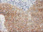 Beta-catenin Antibody in Immunohistochemistry (Paraffin) (IHC (P))