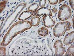 Beta-catenin Antibody in Immunohistochemistry (Paraffin) (IHC (P))