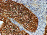 Beta-catenin Antibody in Immunohistochemistry (Paraffin) (IHC (P))