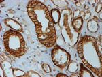 Beta-catenin Antibody in Immunohistochemistry (Paraffin) (IHC (P))