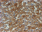 Beta-catenin Antibody in Immunohistochemistry (Paraffin) (IHC (P))