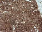 Beta-catenin Antibody in Immunohistochemistry (Paraffin) (IHC (P))